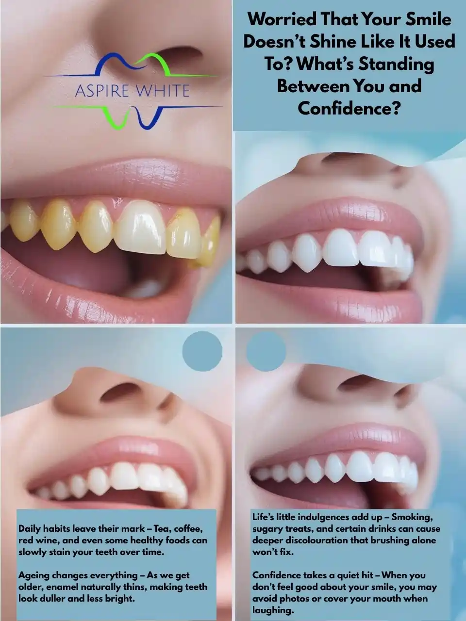 Worried That Your Smile Doesn’t Shine Like It Used To What’s Standing Between You and Confidence Leamington Spa